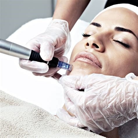 Microneedling Facial
